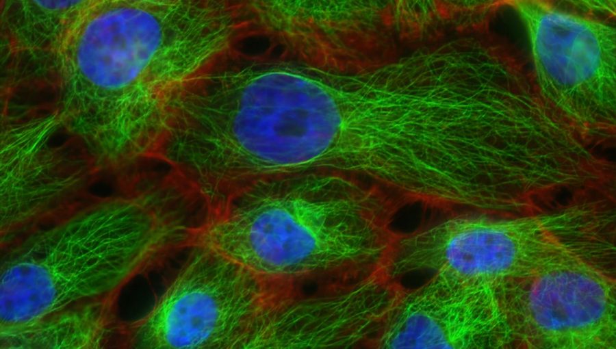 Bunky zafarbené pomocou fluorescenčných farbičiek. Metóda sa bežne používa pri výskume Parkinsonovej choroby, Foto: unsplash/National cancer institute.