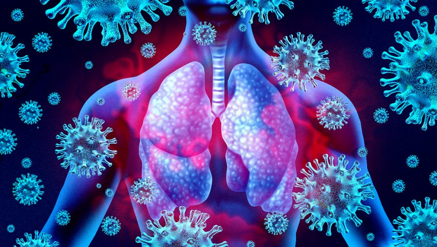 Ilustračný obrázok pľúc napádaných koronavírusom. Zdroj: iStockphoto.com