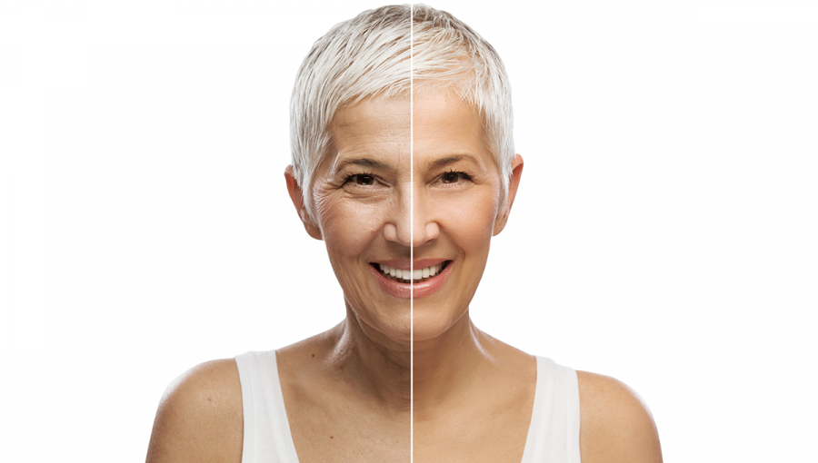 Portrét ženy, ukážka starnutia. Zdroj: iStockphoto.com