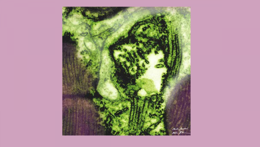 Fotografia s názvom Virus in us and me in science (Vírus v nás a ja vo vede) zobrazuje bunkovú štruktúru, v ktorej možno vidieť antický profil ženskej tváre. Foto: Marta Novotová; Zdroj: katalóg k výstave Creative Resilience: Art by Women in Science (UNESCO)
