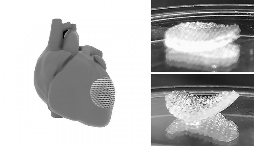 Model srdca, na ktorom je umiestnená vytlačená 3D náplasť. Vedľa je samostatná náplasť, ktorá je ohybná.