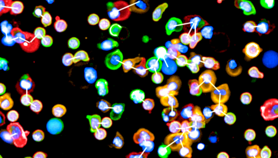 Komunikáciu medzi bunkami imunitného systému približuje fotodokumentácia z výskumu. Foto: Jarrod Skilts Zdroj: Wellcome Sanger Institute