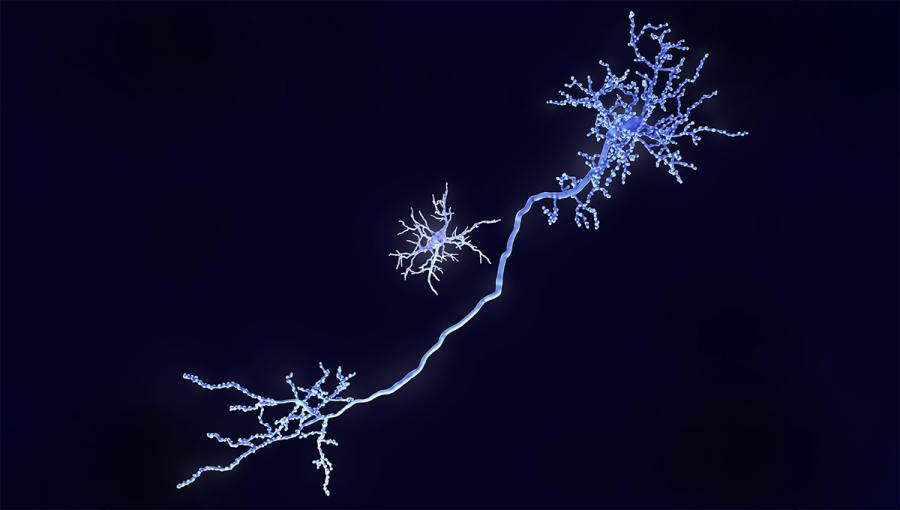 Mikroglia a pyramídový neurón. Zdroj: iStockphoto.com