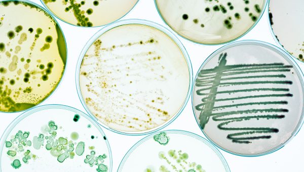 Rastúce mikroorganizmy v Petriho miskách. Zdroj: iStockphoto.com