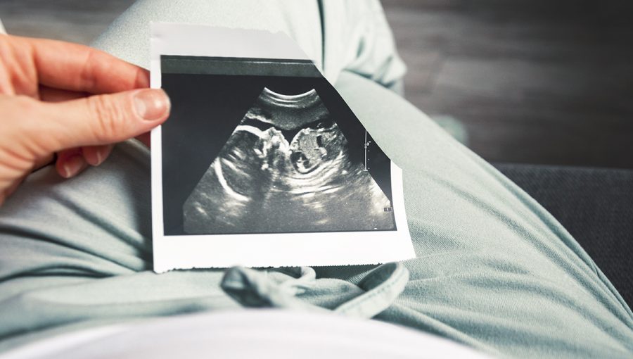 Tehotná žena drží snímku z ultrazvuku. Zdroj: iStockphoto.com