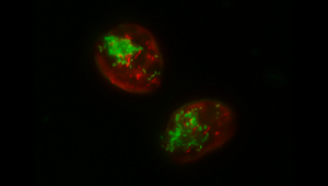 Na snímke je bunka jednobunkovej riasy Cryptomonas gyropyrenoidosa. Snímok bol zhotovený pomocou metódy FISH (fluorescenčná in situ hybridizácia), ktorá naznačuje dva druhy baktérie (červená naznačuje baktériu Megaira polyxenophila, zelená baktériu Grellia numerosa). Foto: Daria Tashyreva, BC AV ČR