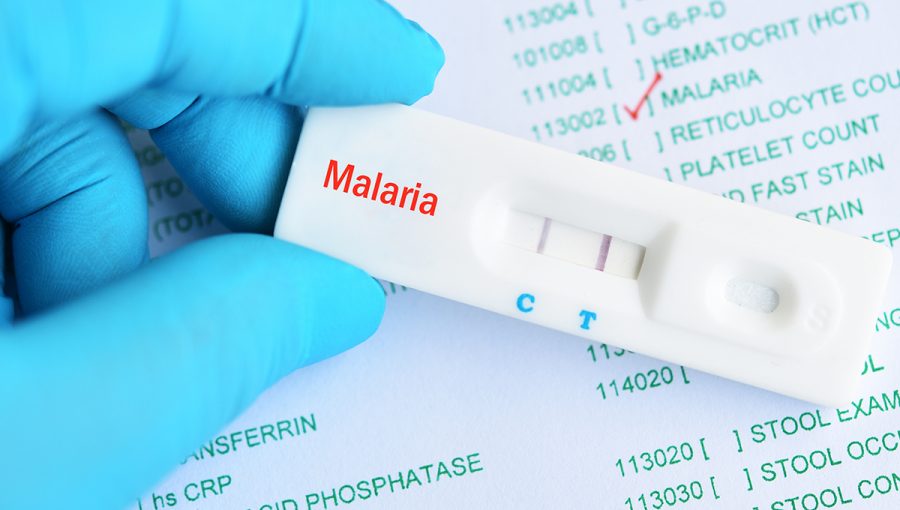 Pozitívny test na maláriu. Zdroj: iStockphoto.com