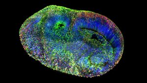 Mikroskopický obraz (horná polovica) a mozaikové zobrazenie (dolná polovica) organoidu ľudského mozgu. Bunky, z ktorých každá nesie inú mutáciu spôsobujúcu autizmus, sú zafarbené odlišne.