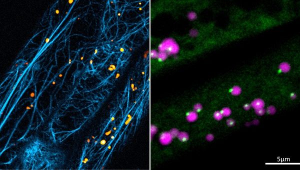 Obrázok vľavo: Aktínový cytoskelet (modrou) tvorí v rastlinných bunkách hustú sieť, ktorá má mnoho rôznych funkcií. Napríklad peroxizómy (oranžová), podobne ako iné organely, sa pomocou molekulárnych motorov myozínov pohybujú po aktínových vláknach ako po bunkovej „železničnej sieti”. Obrázok vpravo: Komplex ARP2/3 na peroxizómoch v pokožkových bunkách rastlín Arábkovky Thalovej (Arabidopsis thaliana). Štruktúry sú označené fluorescenčnými proteínmi. Tie slúžia ako značky umožňujúce detekciu skúmaných štruktúr v živých bunkách. Na snímku z konfokálneho mikroskopu je komplex ARP2/3 zvýraznený zelenou, fialovou farbou peroxizómy. Jan Martinek, katedra Experimentálnej biológie rastlín PřF UK.