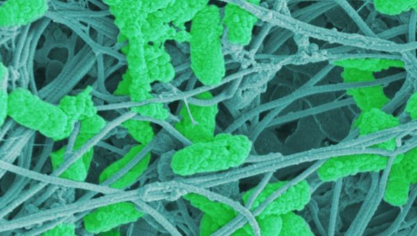Patogény (Pseudomonas aeruginosa, svetlozelené) medzi vláknami spojivového tkaniva ľudskej kože (modrošedé) (skenovacia elektrónová mikroskopia, kolorované).