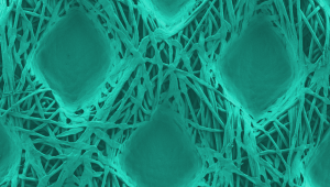 Výsledkom metódy vyvinutej v spoločnosti Empa je rovnomerné rozloženie antimikrobiálneho povlaku na textilných vláknach. Skenovacia elektrónová mikroskopia, 30 000-násobné zväčšenie, farebná.
