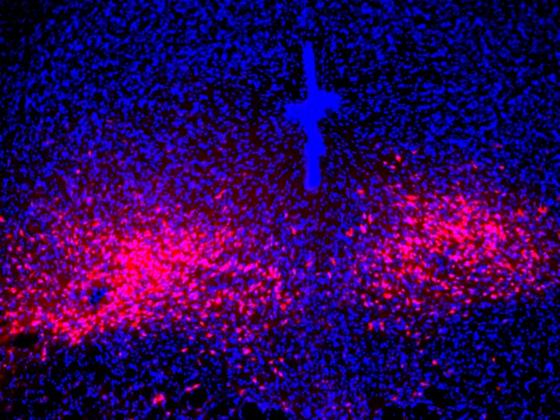 Neuróny v nucleus raphes dorsalis. Zdroj: Salkov inštitút pre biologické zdravie