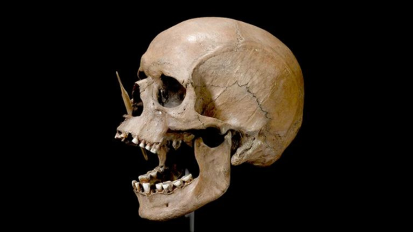 Lebka muža bola prepichnutá šípom pred tisíckami rokov, žil v dnešnom Dánsku. Zdroj: The Danish National Museum