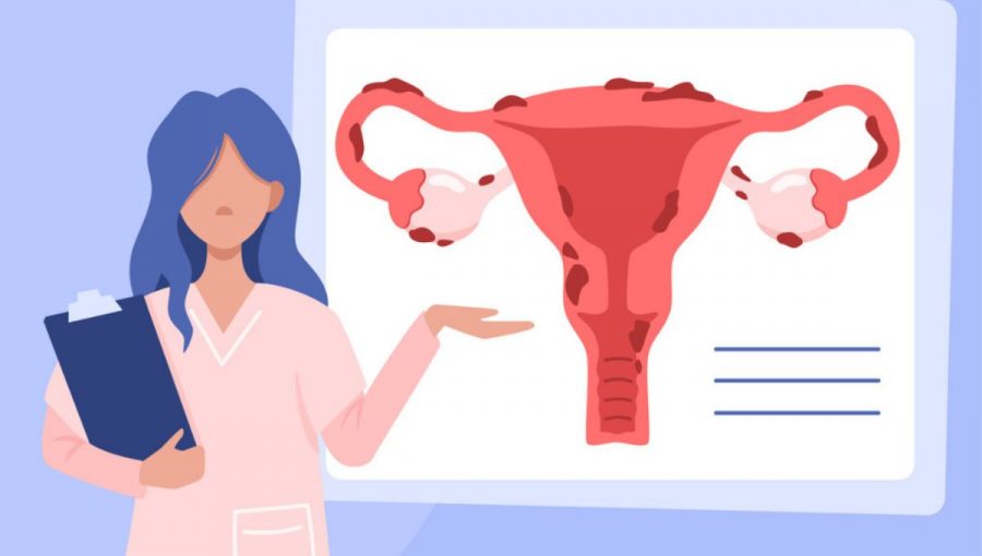 Lekári dodnes nepoznajú príčiny endometriózy. Ochorenie je zrejme hormonálneho pôvodu. Zdroj: iStockphoto.com