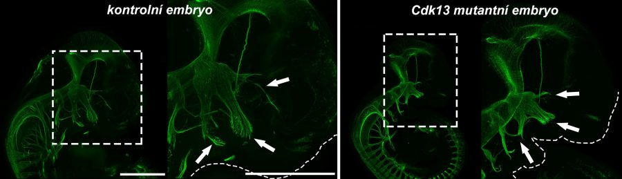 Vývoj tvárových nervov u 11,5 dňa starých myších embryí – vľavo normálny vývoj hlavových nervov u kontrolného embrya a vpravo vývoj hypoplastickcýh nervov u Cdk13 mutantného embrya. Zeleno sfarbené neurofilamentá – imunohistochemicky zafarbené vláknité proteíny nervových buniek znázorňujú vyvíjajúce sa nervy a nepravidelné prerušované čiary naznačujú obrys vyvíjajúcej sa tváre. Vždy vľavo menšie zväčšenie, vpravo detail hlavovej oblasti so šípkami ukazujúcimi na tri hlavné vetvy trigeminálneho nervu prerastajúce do hlavných tvárových častí. Foto: N. Jandová.