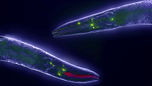 Háďatko obyčajné (Caenorhabditis elegans). Zdroj: iStockphoto.com