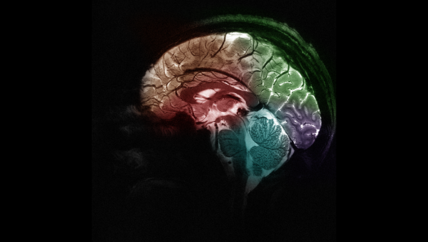 Snímka ľudského mozgu zachytená novým prístrojom Iseult MRI s výkonom 11,7 Tesly. Zdroj: CEA