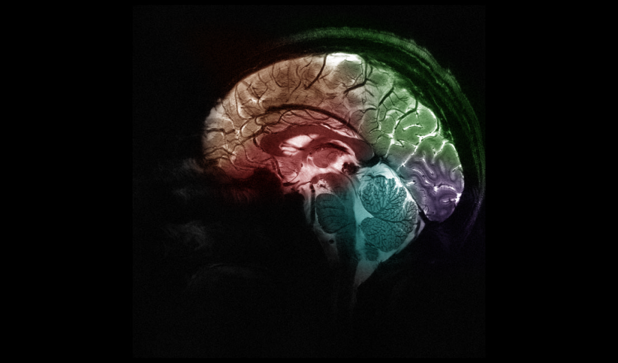 Snímka ľudského mozgu zachytená novým prístrojom Iseult MRI s výkonom 11,7 Tesly. Zdroj: CEA