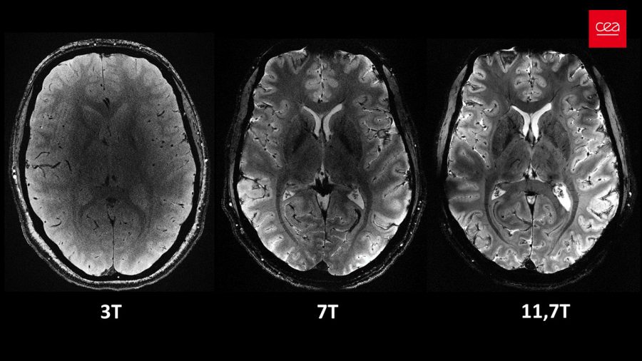 Porovnávacie snímky ľudského mozgu zachytené pomocou nového prístroja Iseult MRI pri rôznych úrovniach výkonu – 3 Tesla (T), 7 T a 11,7 T. Všetky boli nasnímané za rovnaký čas. Zdroj: CEA
