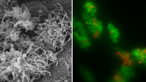 Baktéria B. pertussis naviazaná na ľudské riasinkové bunky dýchacej sliznice zobrazená elektrónovým mikroskopom (obr. vľavo) a fluorescenčným mikroskopom (obr. vpravo).