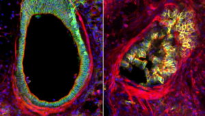 Na ľavej strane je otvorené zdravé tkanivo epitelových buniek a na pravej strane zhluk epitelových buniek na myšom tkanive. Zdroj: DOI 10.1126/science.adk2758