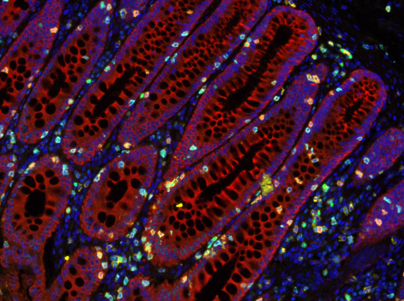 Imunohistochemický obrázok tkaniva zdravého hrubého čreva. Zdroj: Olivia Newton-John Cancer Research Institute 