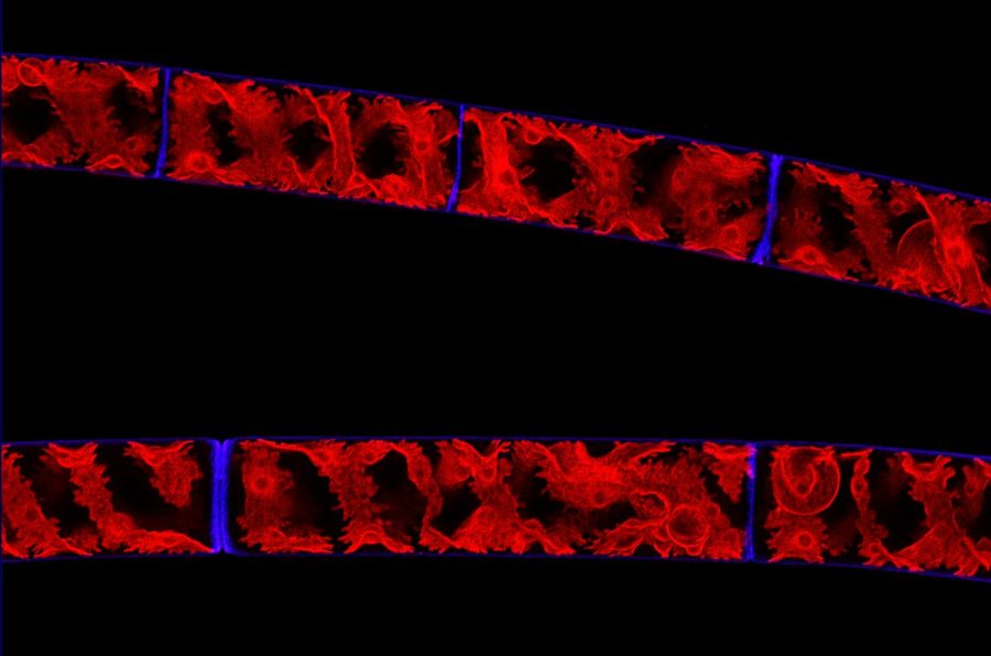 Spirogyra (skrutka) a jej očarujúce skrutkovité chloroplasty, ktoré červeno fluoreskujú pri vystavení ultrafialovému žiareniu. Foto: Vojtech Schmidt.