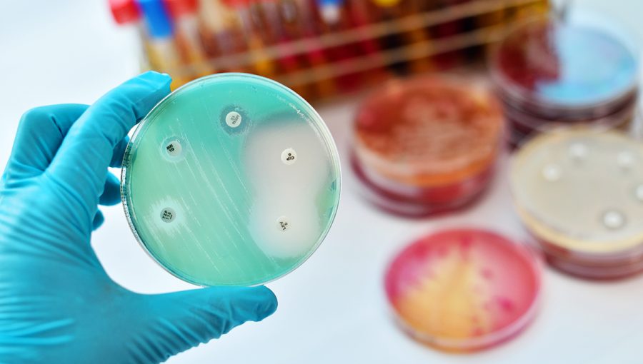 Vyšetrenie citlivosti na antimikrobiálne látky. Zdroj: iStockphoto.com