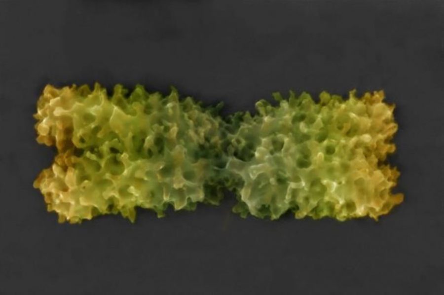 Kolorované snímky chromozómu v natívnom stave získané pomocou novo vyvinutej pokročilej environmentálnej rastrovacej elektrónovej mikroskopie. Zdroj: ÚPT AV ČR