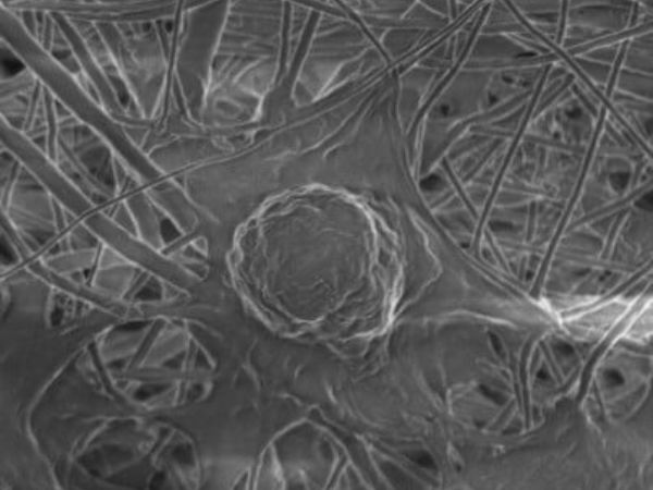 Dendritická bunka na membráne z nanovláken.