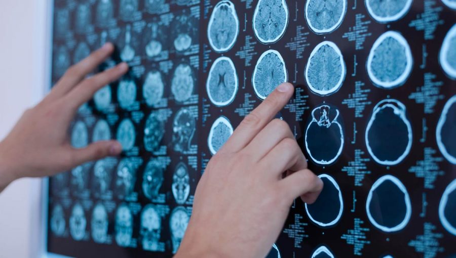 Röntgenové snímky mozgu. Zdroj: iStock.com/Zinkevych