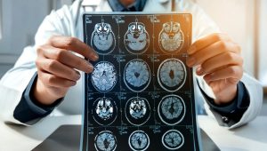 MRI scan mozgu. Zdroj: iStock/Makhbubakhon Ismatova