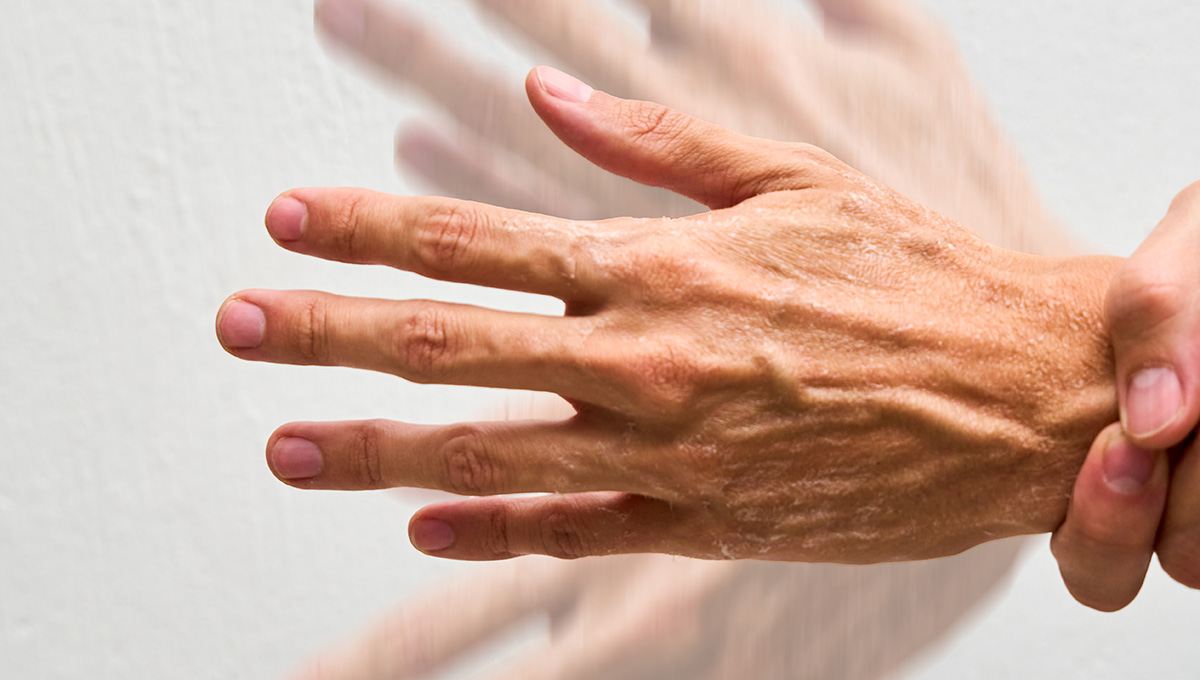 Trasenie rúk. Zdroj: iStock.com/Fabian Montano