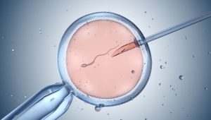 Umelé oplodnenie. Zdroj: iStock/iLexx