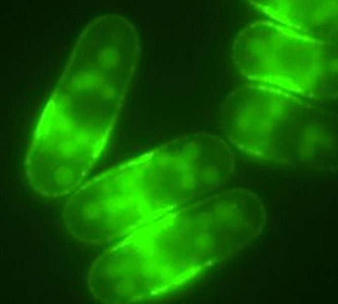 Bunky kvasiniek, v ktorých je transportér glukózy Ght5 fluorescenčne značený zeleným fluorescenčným proteínom (GFP).