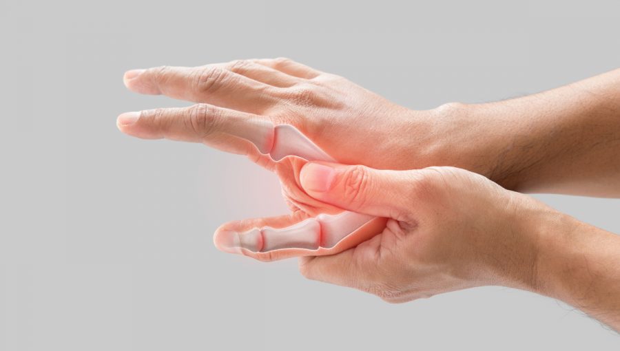 Bolesť a zápal na kĺboch dlane. Zdroj: iStock.com/Tharakorn