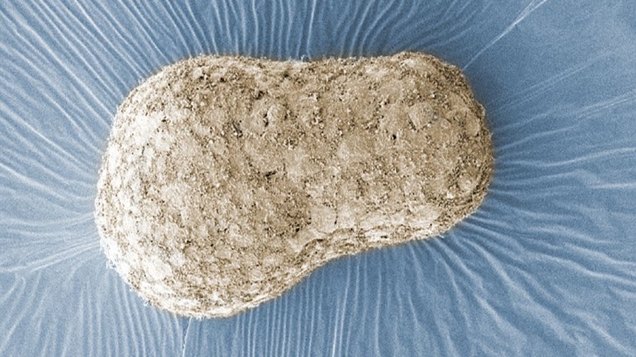 Obrázok modelu ľudského embrya, ktorý vyvinula výskumníčka Naomi Morisová z Inštitútu Francisa Cricka v Londýne. Zhotovený bol technikou nazývanou skenovacia elektrónová mikroskopia a zobrazuje zhluk buniek v troch rozmeroch. Zdroj: Naomi Morisová