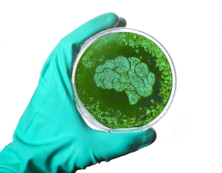 Mozog v Petriho miske (ilustrácia). Zdroj: iStock/eyegelb