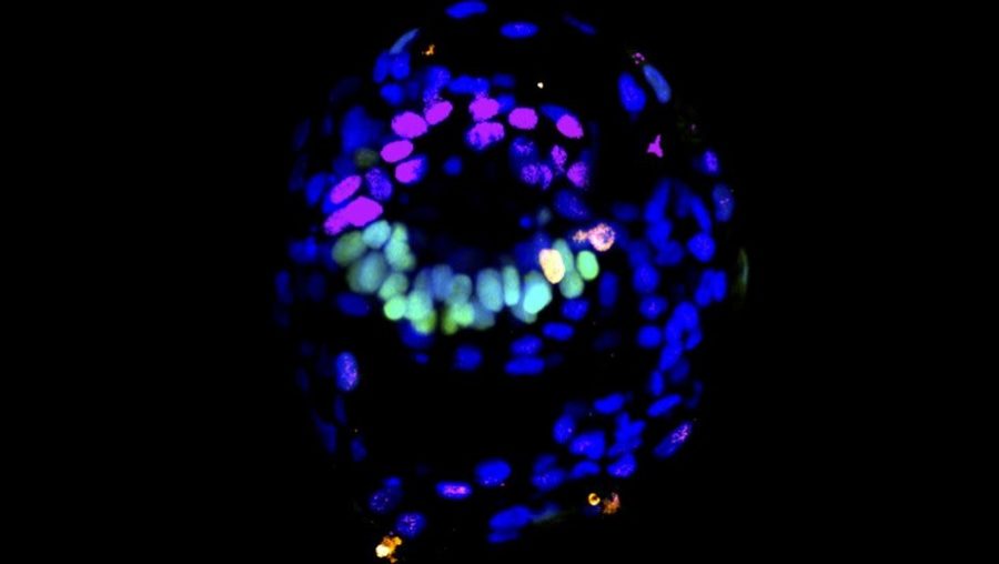 Štruktúra podobná ľudskému embryu vytvorená z preprogramovaných kmeňových buniek. Budúce somatické bunky sú sfarbené na zeleno a amnion je znázornený ružovou farbou, pričom sa tvorí na opačných stranách a oddeľuje ho amniotická dutina. Zdroj: Laboratórium Weatherbee a Gantner/Zernicka-Goet