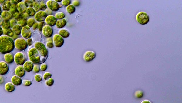 Mikróby. Zdroj: iStock/Namscience