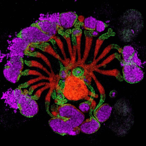 Pomocou ľudských kmeňových buniek vedci vypestovali tento organoid, ktorý obsahuje glomeruly (fialové), podjednotky filtrujúce krv v skutočnej obličke. Zdroj: Zhongwei Li