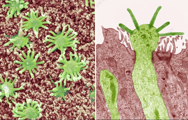 Čuchové receptory. Vľavo sú nasnímané skenovacím elektrónovým mikroskopom (SEM), vpravo transmisným elektrónovým mikroskopom (TEM). Nervová bunka (zelená) sa nachádza v nosovom epiteli. Zhrubnutá časť bunky je čuchový mechúrik. Z neho vyčnievajú malé chĺpky (riasinky) – čuchové (olfaktorické) receptory. Informácie z týchto receptorov sa prenášajú do čuchového bulbu v mozgu, kde sa spracovávajú. Aby bolo možné látku cítiť, musí byť plynná a rozpustná vo vode a tukoch. V ľudskom nose sa nachádza viac ako milión čuchových receptorových buniek. Kredit: Steve Gschmeissner/SCIENCE PHOTO LIBRARY 