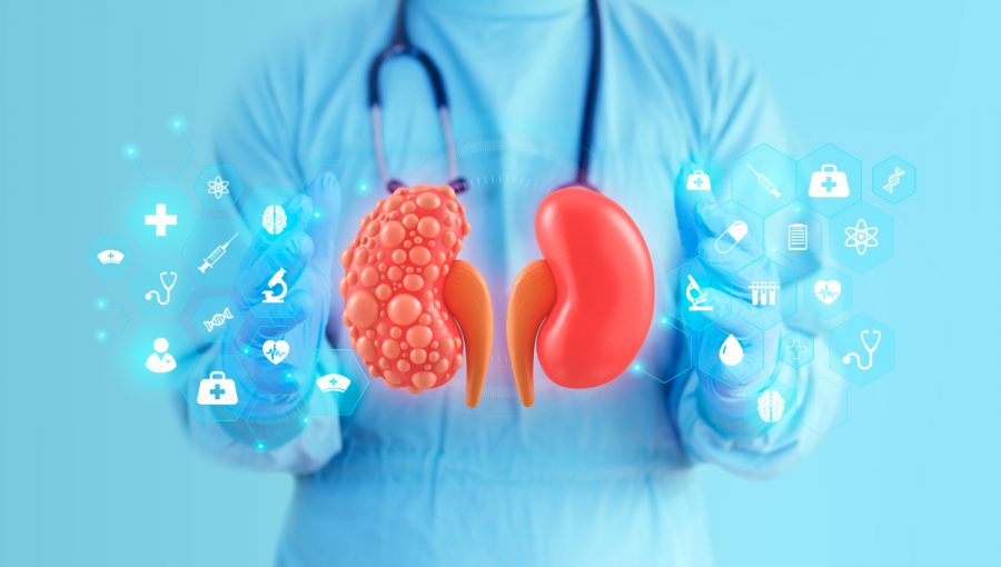 Obličky. Zdroj: iStock.com/Marco Marca