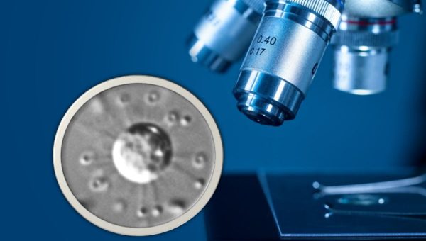 Koláž: Solarion arienae (Valt a kol., Nature, 2025), iStock/SergeyKlopotov