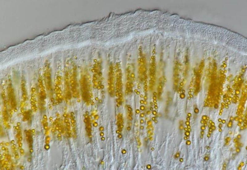 Vedci si spočiatku mysleli, že tieto guľovité žlté granule môžu byť symbiotické mikróby, ale ukázalo sa, že ide o biomineralizované minerály arzénu.