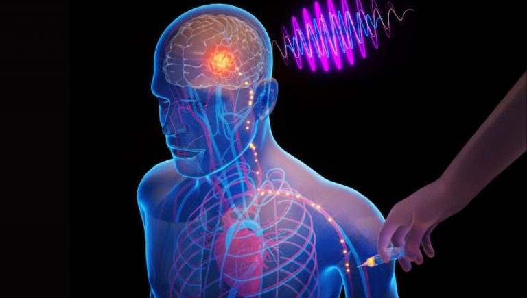 Prelomová technológia cirkulatroniky z MIT využíva drobné čipy vstrekované do krvného obehu a prenášané do mozgu, čím dochádza k eliminácii potreby invazívnej chirurgie na liečbu neurologických porúch.