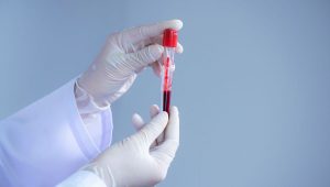 Krvná vzorka. Zdroj: iStock/undefined undefined