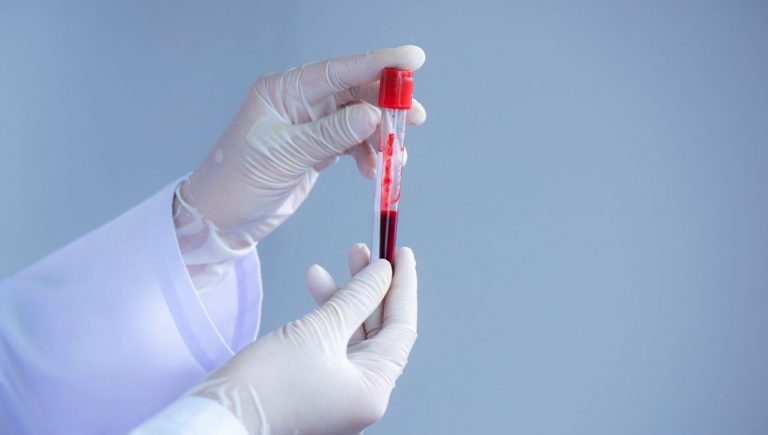 Krvná vzorka. Zdroj: iStock/undefined undefined