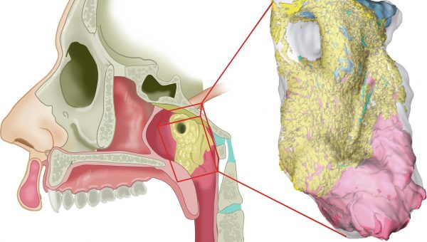 3D rekonštrukcia nového orgánu podľa skenu PSMA PET-CT. Zdroj: M. Valstar, W. Vogel a ďalší