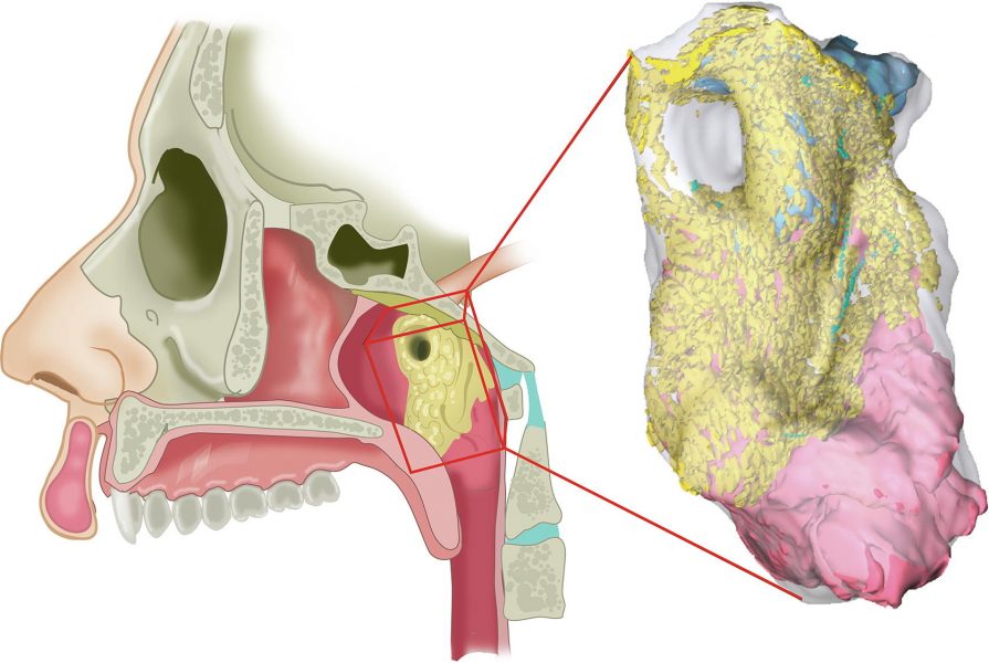 3D rekonštrukcia nového orgánu podľa skenu PSMA PET-CT. Zdroj: M. Valstar, W. Vogel a ďalší